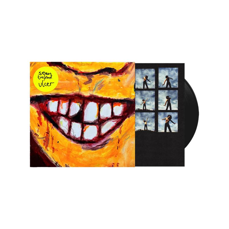 Ulcer Standard LP